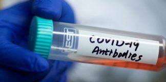 FDA Reverses Itself: Rejects COVID Antibody Test Results; Insanity Reigns
