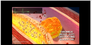 Red Alert: Renowned Cardiac Surgeon Steven Gundry Warns mRNA COVID-19 Vaccines More Than Double The Risk of Heart Attack/ By Bill Sardi