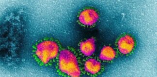 COVID-19 Was Downgraded to “Flu Level” in March 2020. “No Longer Categorized as a High Consequence Infectious Disease (HCID)”