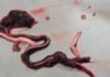 Embalmers Discover Strange, Rubbery ‘Worms’ in Bodies of the Jabbed/ By Free West Media