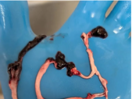Gloved hand holding several thin, twisted worms or larvae.