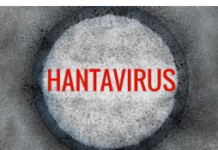 “Global Health Scare”: “Dangerous Hantavirus” On Board Dutch Cruise Ship./By Prof Michel Chossudovsky Remember? The Diamond Princess Cruise Ship in February 2020. Sets the Stage for Announcing The Covid-19 Pandemic/